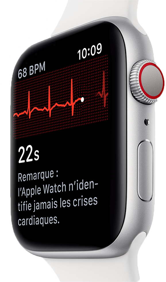 visuel Apple Watch sous différents angles